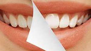 teeth_012818.jpg