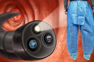 colonoscopy.jpg