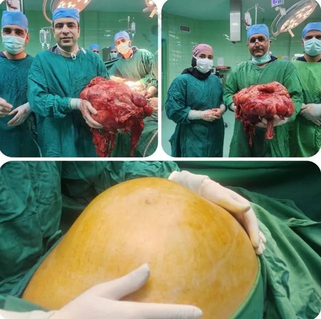 tumor.jpg